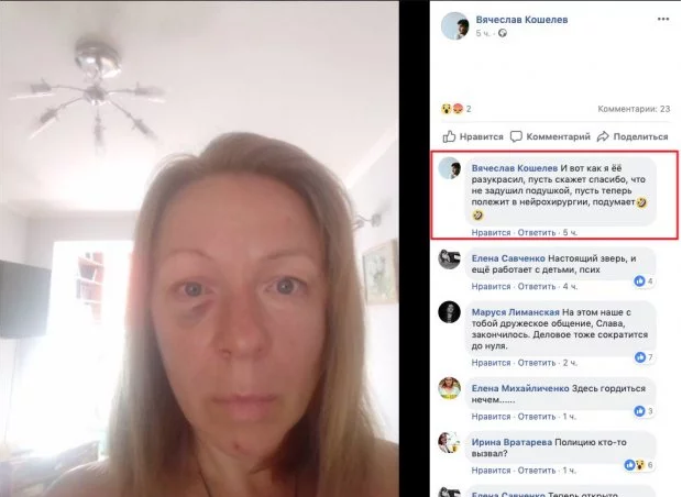 Актер запрещенного в Украине сериала избил бывшую жену и похвастался в Facebook: опубликованы фото