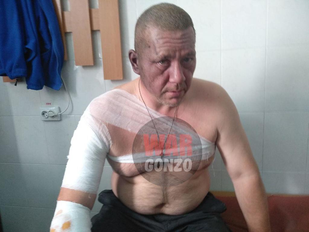 Взрыв на съезде в Донецке: появилось первое видео с места ЧП и фото пострадавшего Хакимзянова