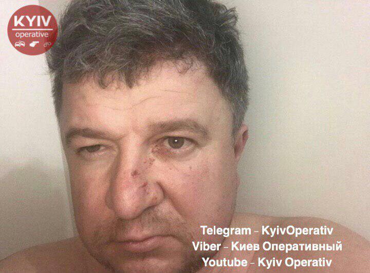 Максим Чаленко влаштував п'яний дебош в Києві: хто він і чим відзначився раніше