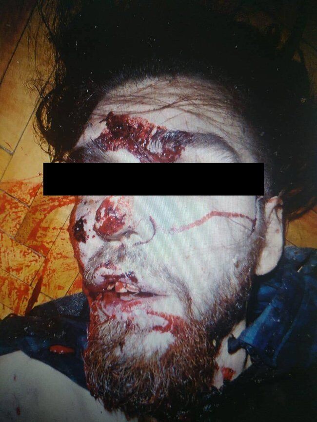 Луан Кингисепп: фото трупа убийцы водителя BlaBlaCar 18+