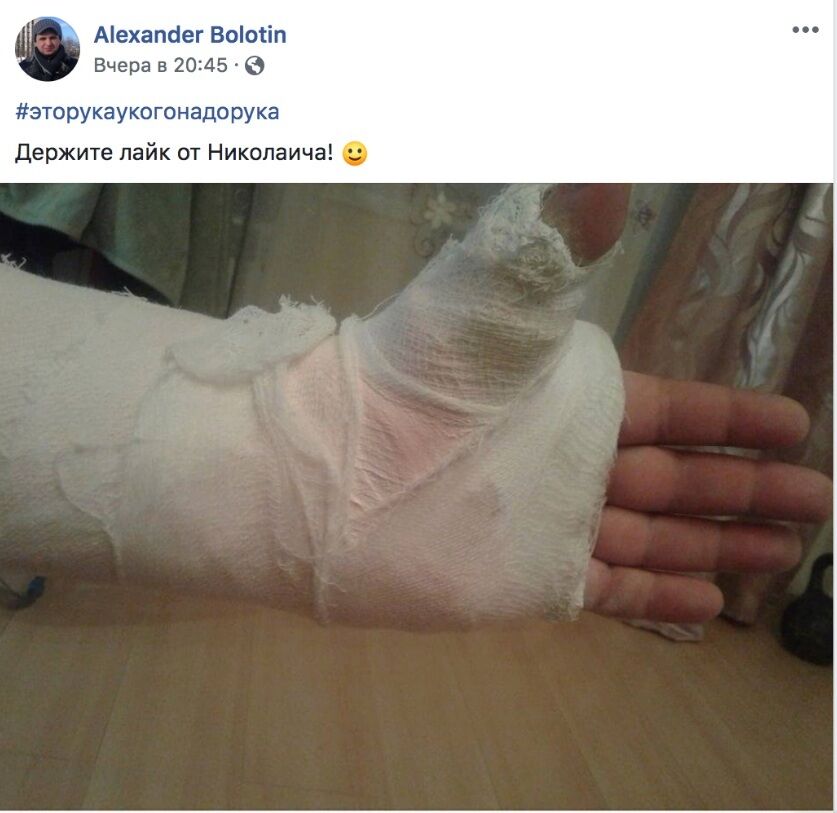 Александр Болотин избит: кто он, его фото и как называл ''ДНР'' дерьмом