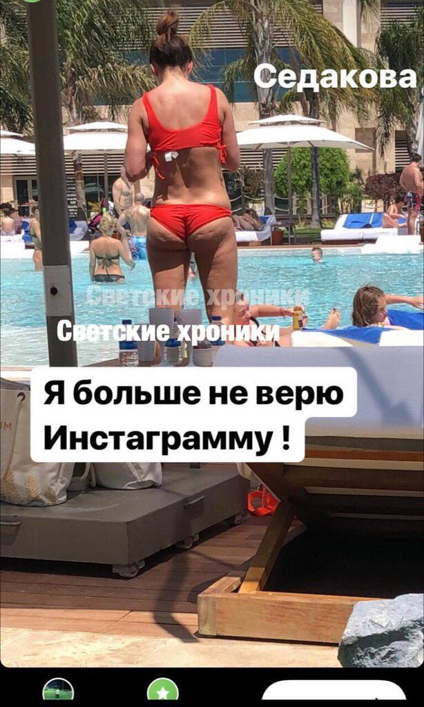 Анна Седокова жахнула справжнім фото свого інтимного місця