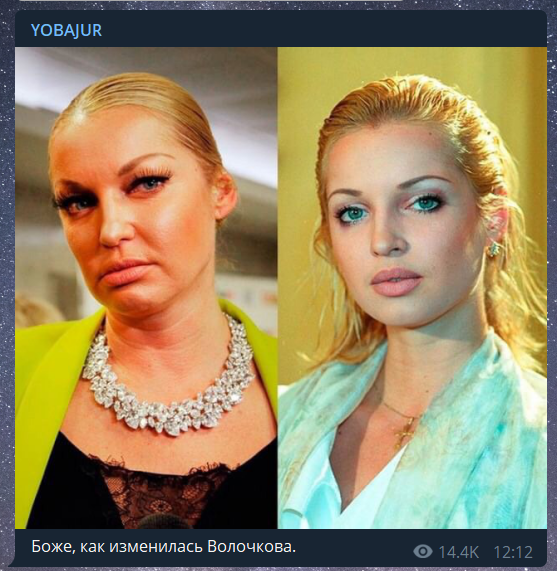 Волочкова шокировала постаревшим внешним видом: фото до и после