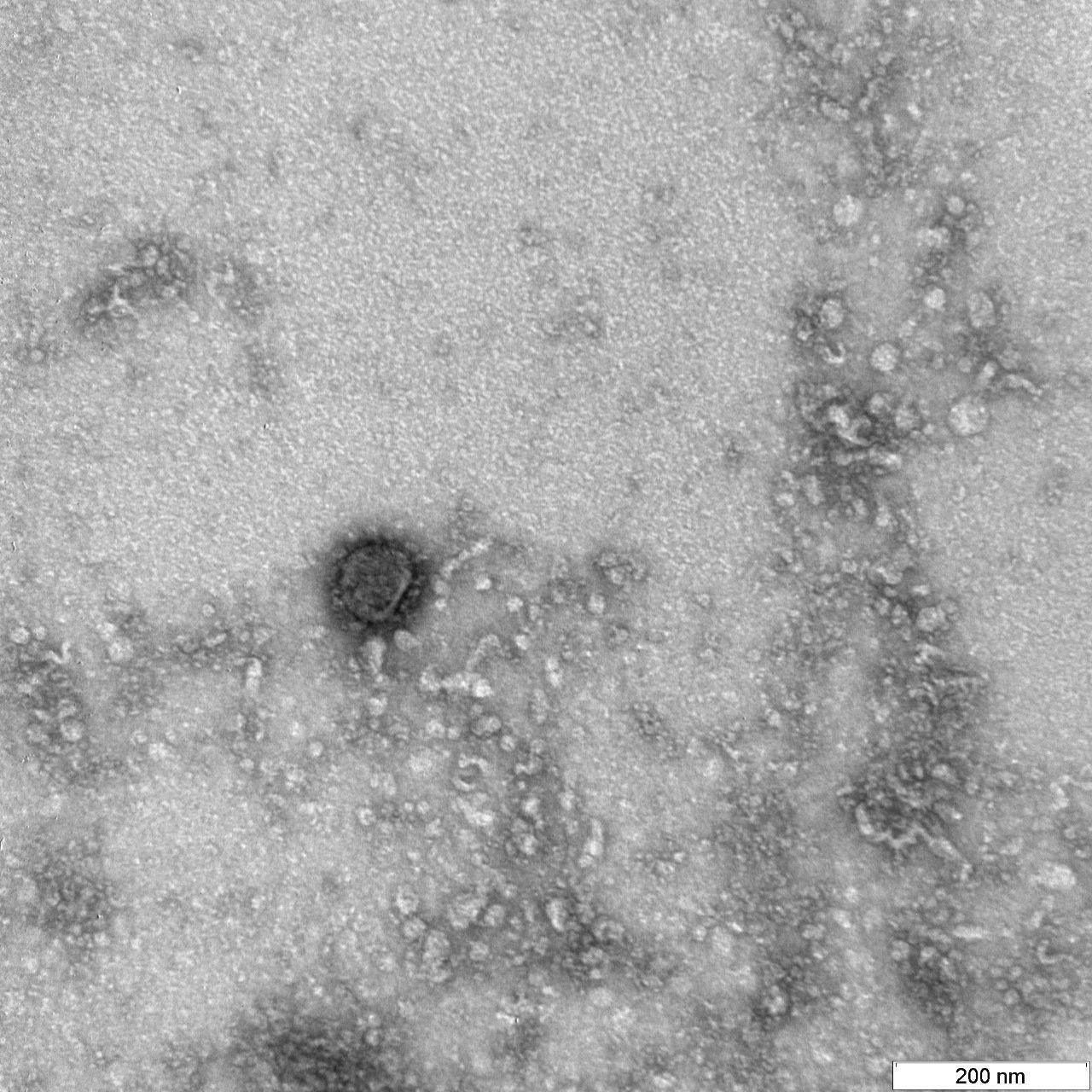 Фото, як виглядає коронавірус COVID-19 під мікроскопом