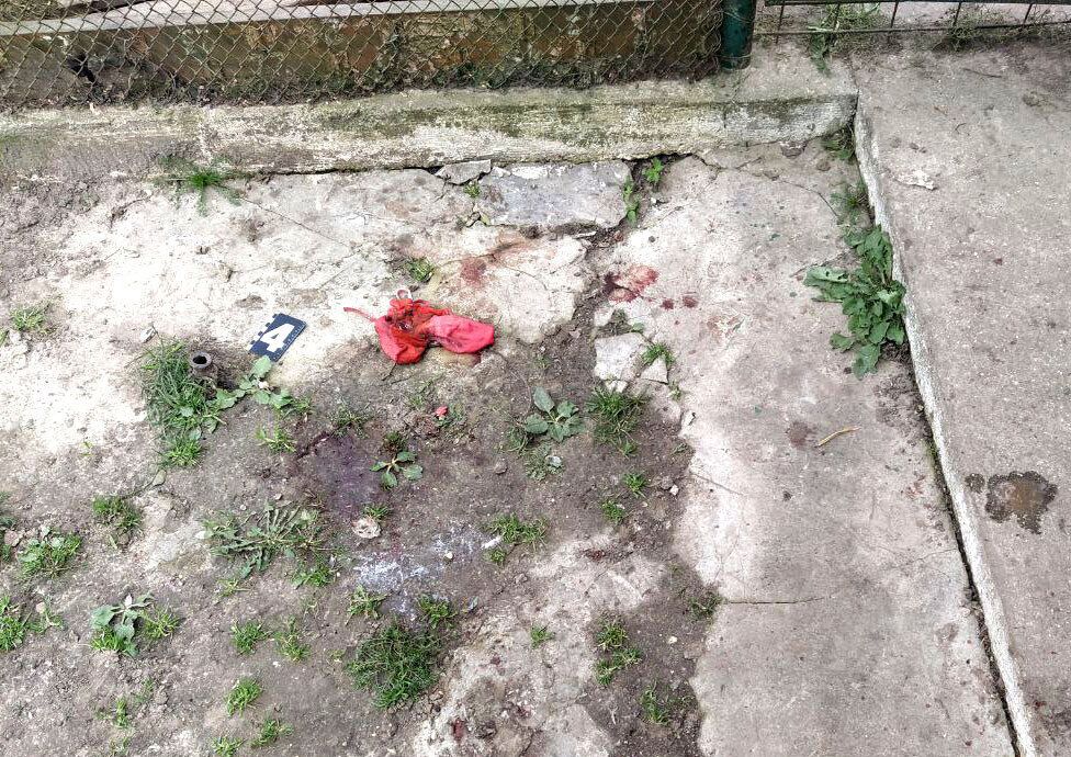 У Рівненській області помер півторамісячний хлопчик через вівчарку