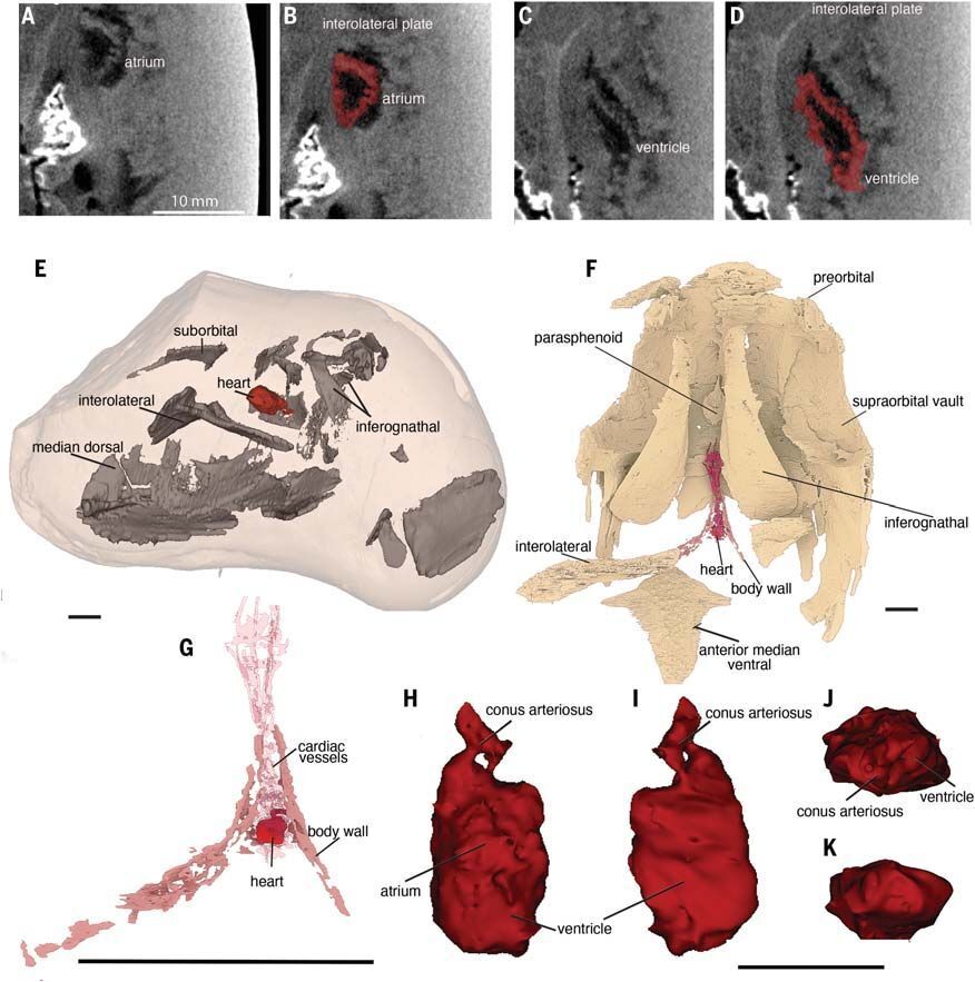 Сканирование показало невероятные подробности о сердце, включая желудочки и предсердия