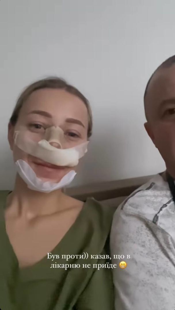 Екатерина Репьяхова сделала пластическую операцию и показала фото