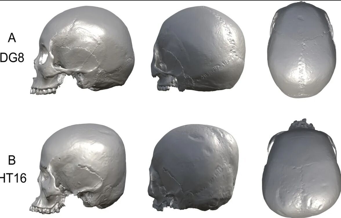 Ученые выяснили, для чего народ Хирота в Японии намеренно деформировал черепа детям