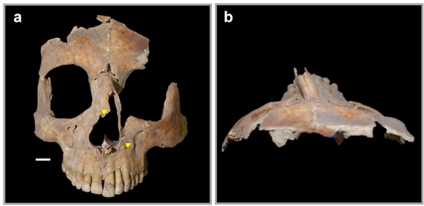 The oldest evidence of brain surgery discovered in Israel (photo)