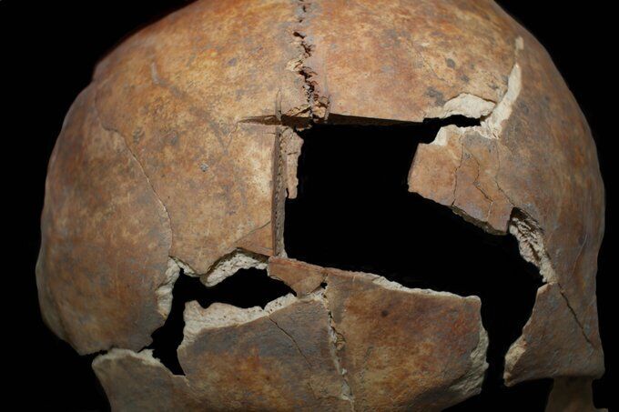 The oldest evidence of brain surgery discovered in Israel (photo)