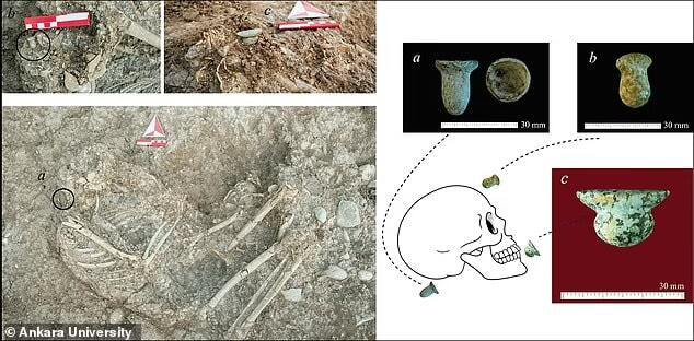 У Туреччині виявили найдавніші докази перфорації тіла в скелетах віком 11 тисяч років (фото)