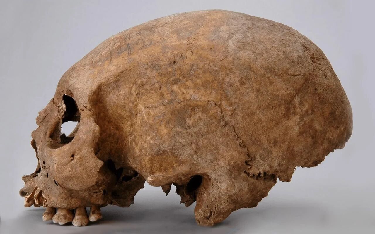 Three strange modifications of skulls have been found in women of the Viking era (photo)
