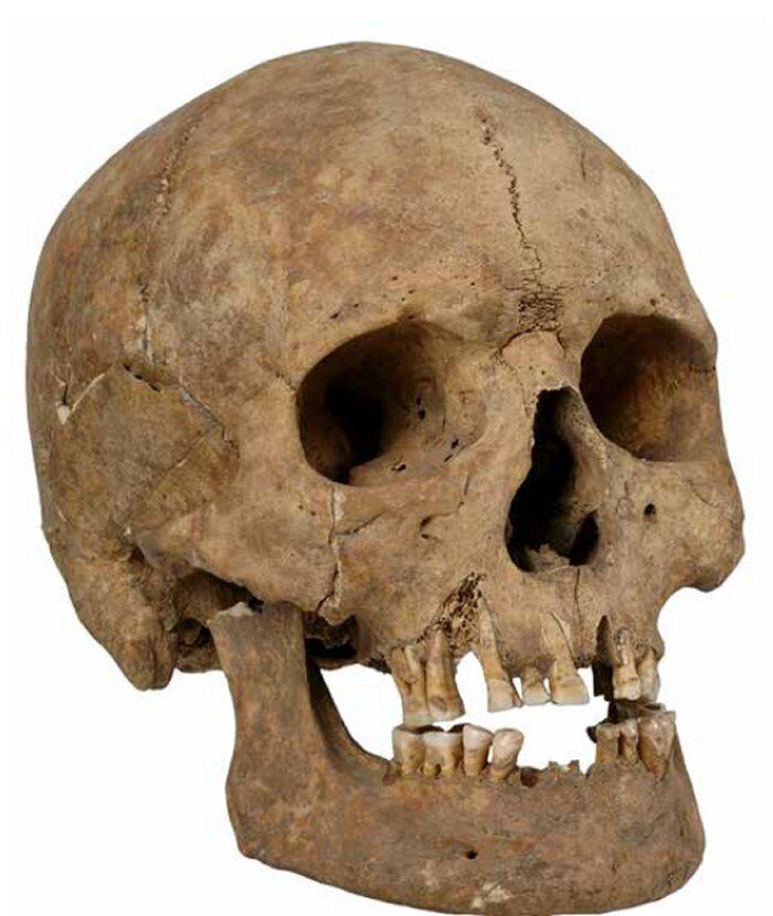 У женщин эпохи викингов обнаружены три удивительные модификации черепов (фото)
