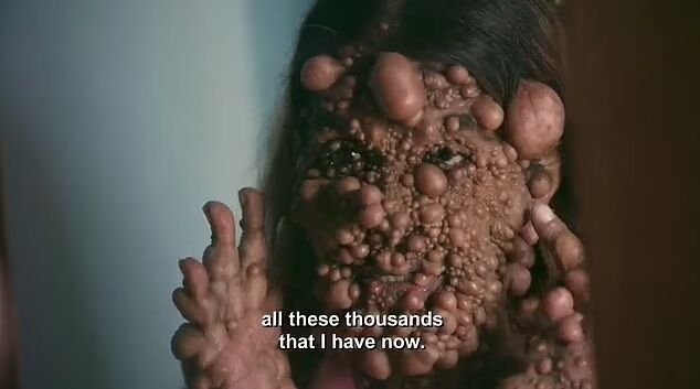 Генетична хвороба перетворила жінку на ''прибульця'': чому лікарі не можуть допомогти (фото)
