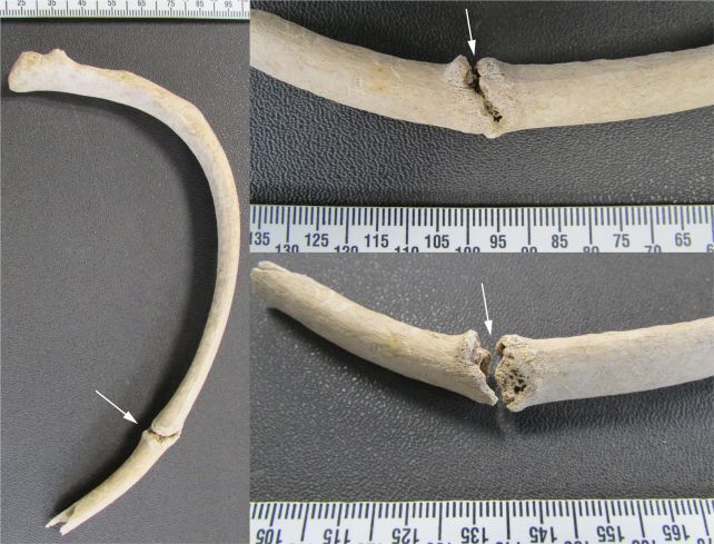 Стала жертвой кровавой расправы: в Англии обнаружили 2000-летний скелет молодой девушки (фото)