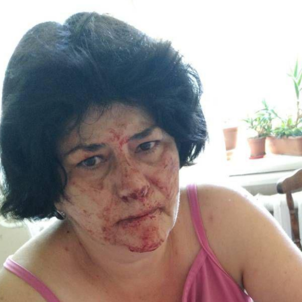 Під Києвом жорстоко побили жінку через зауваження: опубліковано фото