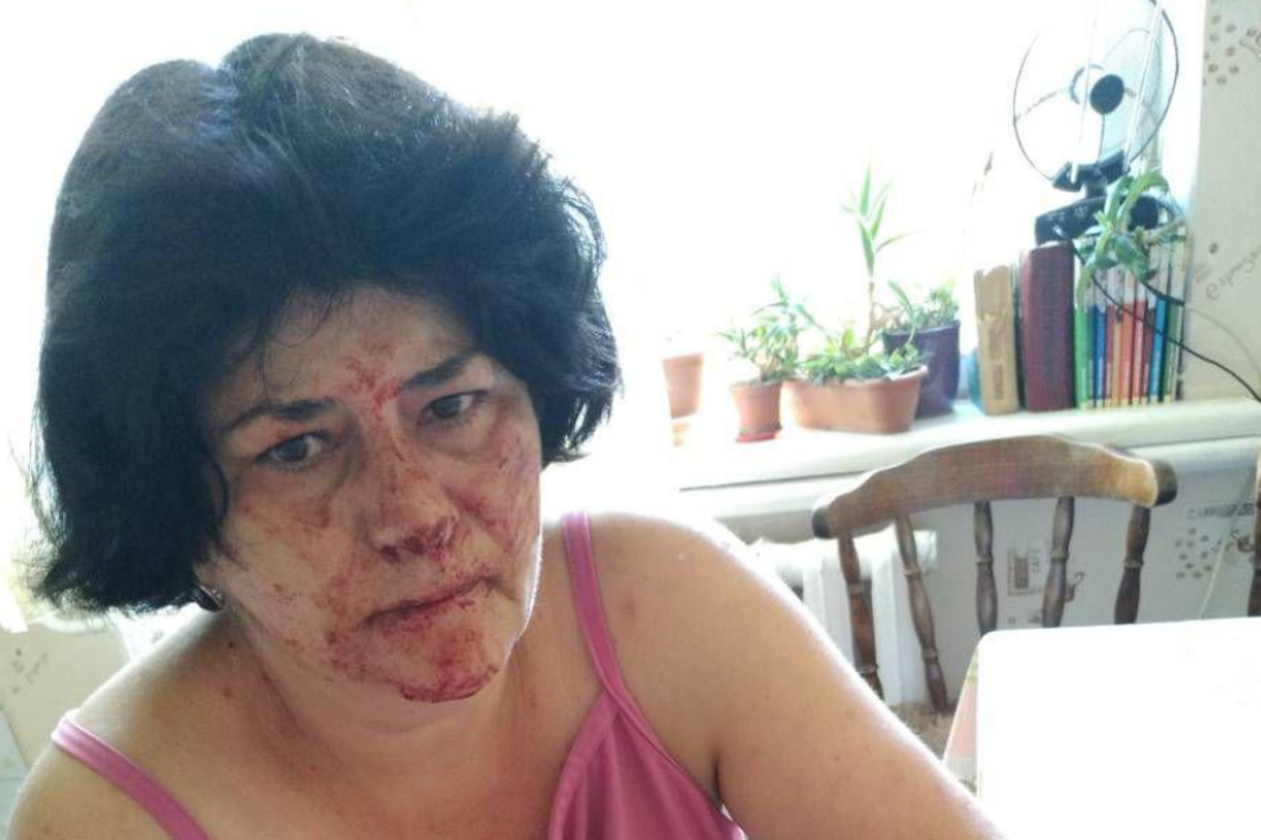 Під Києвом жорстоко побили жінку через зауваження: опубліковано фото