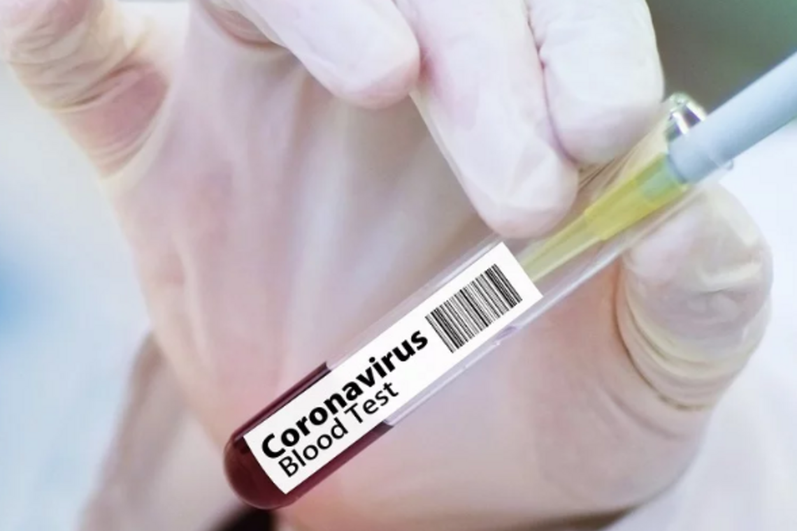 Где сдать и сколько стоит тест на коронавирус COVID-19 в Украине