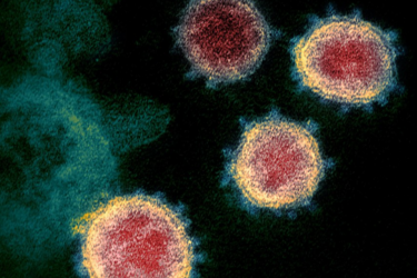 Кого найчастіше вбиває коронавірус і в чому проблема лікування