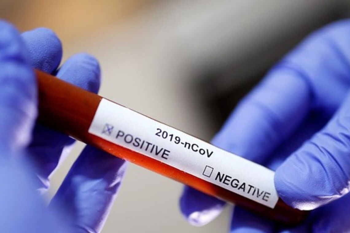 В Украине резко вырос суточный показатель заболеваемости коронавирусом