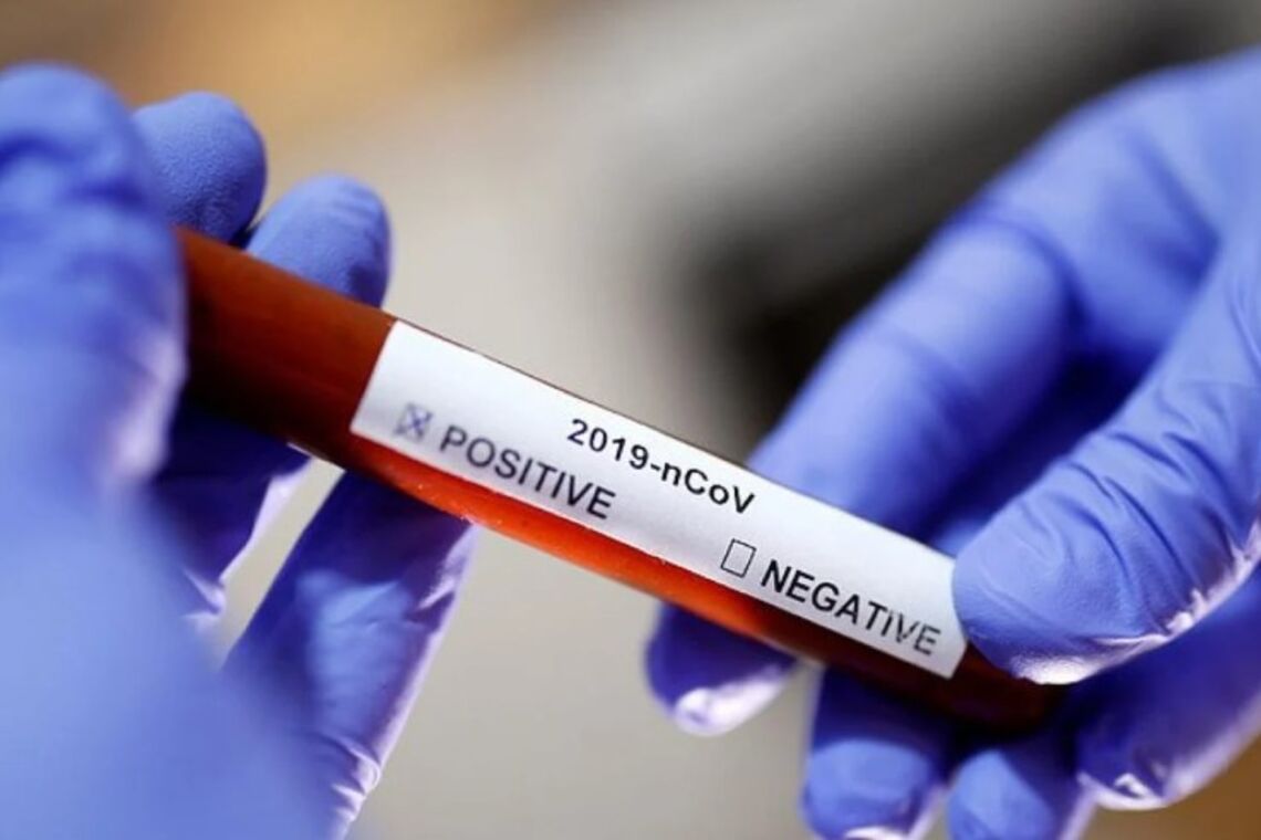 Количество инфицированных коронавирусом в США превысило 3 миллиона