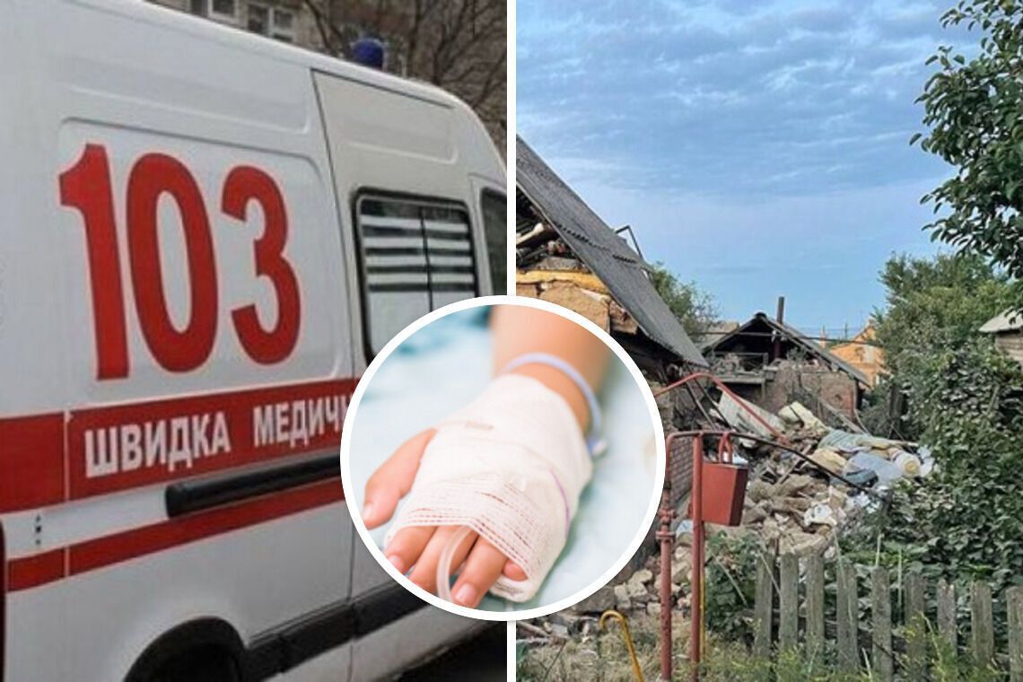 Після російської атаки на Нікополь 6-річній дитині ампутувало ноги: медики борються за життя