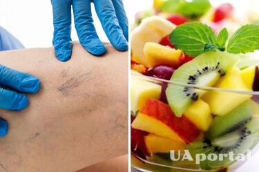 Лікарі назвали три фрукти, які допоможуть уникнути тромбозу