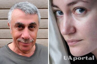 Може погіршитися пам'ять, зір та виникнути труднощі при ходьбі: Комаровський розповів, чим небезпечна блідість шкіри