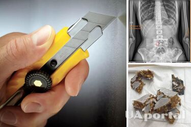 В Днепре женщина нашла острые обломки ножа в батончике