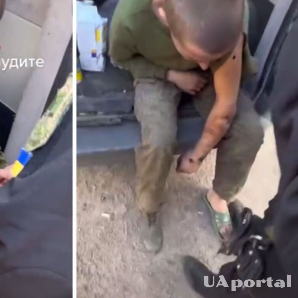 ВСУ показали, как оказывают медицинскую помощь пленному оккупанту, в ране которого завелись черви (видео)