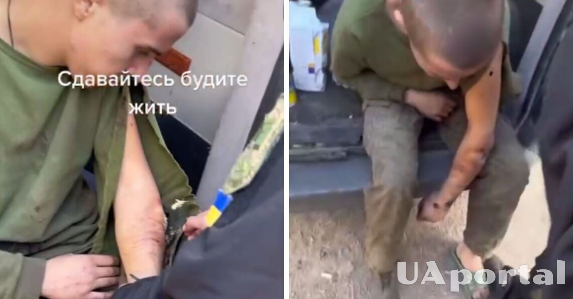 ВСУ показали, как оказывают медицинскую помощь пленному оккупанту, в ране которого завелись черви (видео)