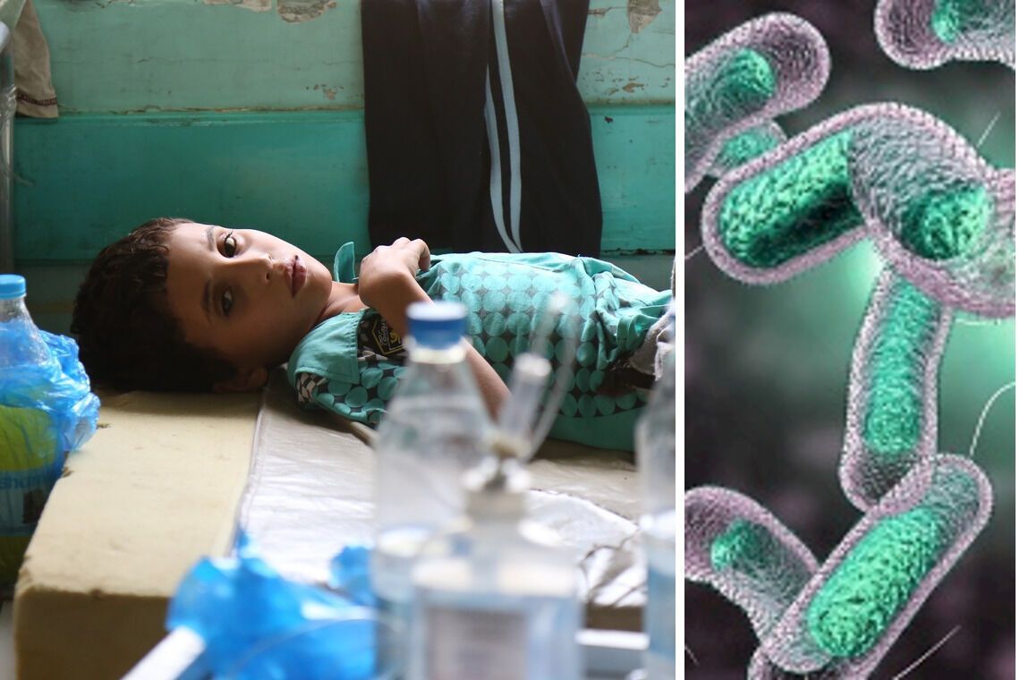 Может убить за несколько часов: в мире выросла заболеваемость холерой