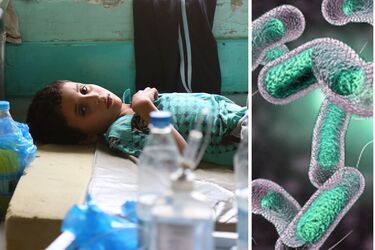 Може вбити за кілька годин: у світі зросла захворюваність на холеру