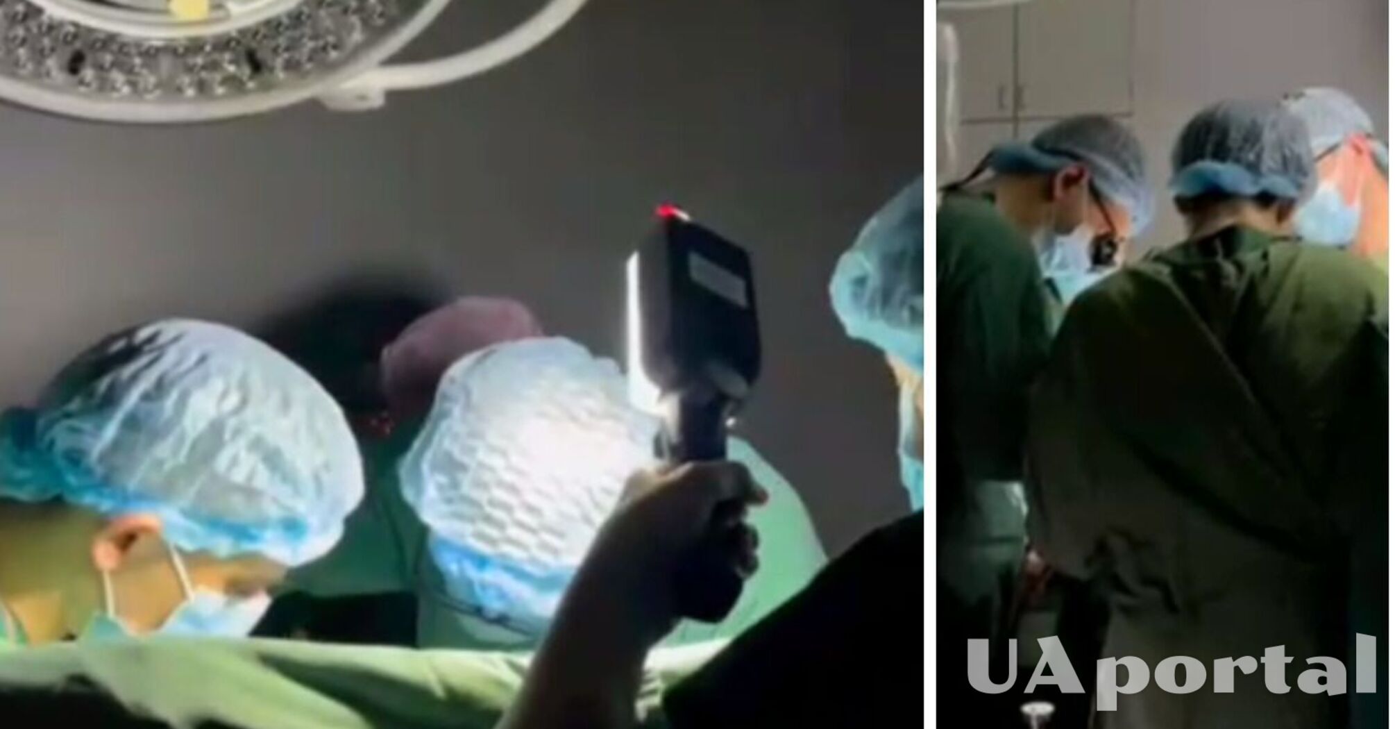Украинские хирурги продолжили операцию на сердце во время блекаута (видео)