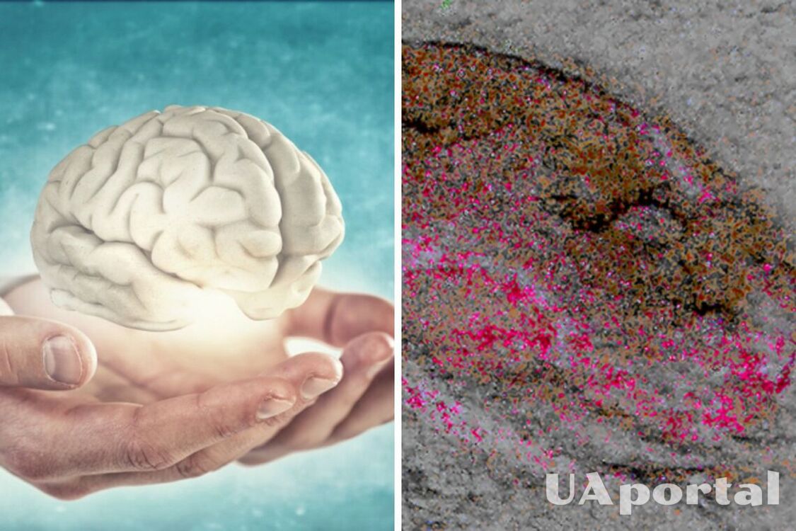 Ученые опровергли теорию об эволюции мозга благодаря окаменелости в возрасте 525 млн лет (фото)