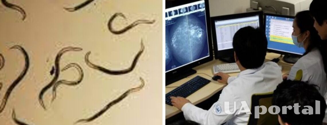Ученые Японии научились обнаруживать рак с помощью червей