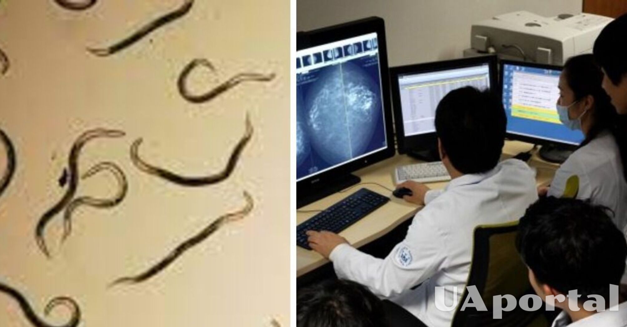 Вчені Японії навчилися виявляти рак за допомогою хробаків