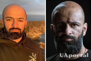Українці захопились фото бійця Масі Найєма, яке він опублікував після поранення