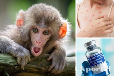 Обезьяна оспа: что это за заболевание и какие имеет симптомы