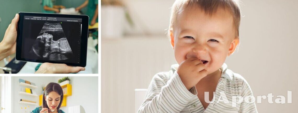 Від моркви малюк на УЗД усміхається, а броколі не любить: вчені показали як плід реагує на їжу (фото)