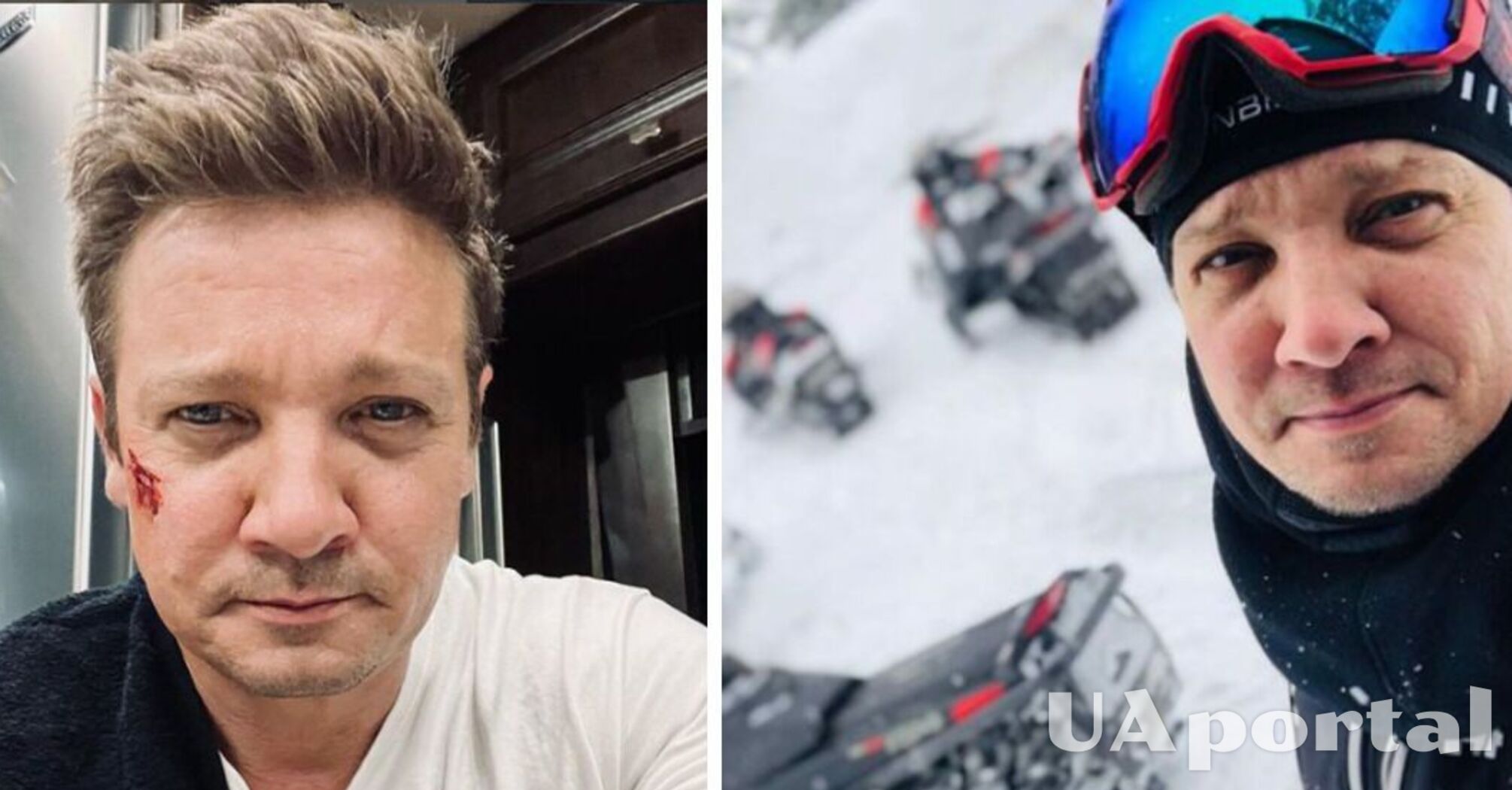 Звезда Marvel Джереми Реннер рассказал, как сломал более 30 костей во время уборки снега и поделился фото