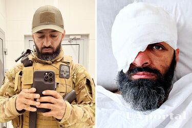 Нашли новые осколки в голове: адвокат Маси Найем, потерявший глаз на войне, готовится к очередной операции (фото)