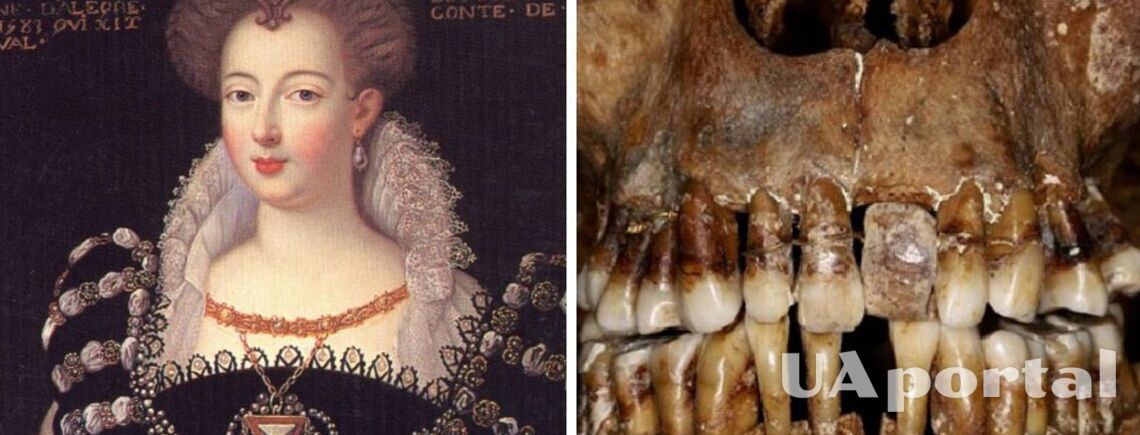 Исследователи рассказали, какая французская графиня держала зубы во рту с помощью золотой проволоки (фото)