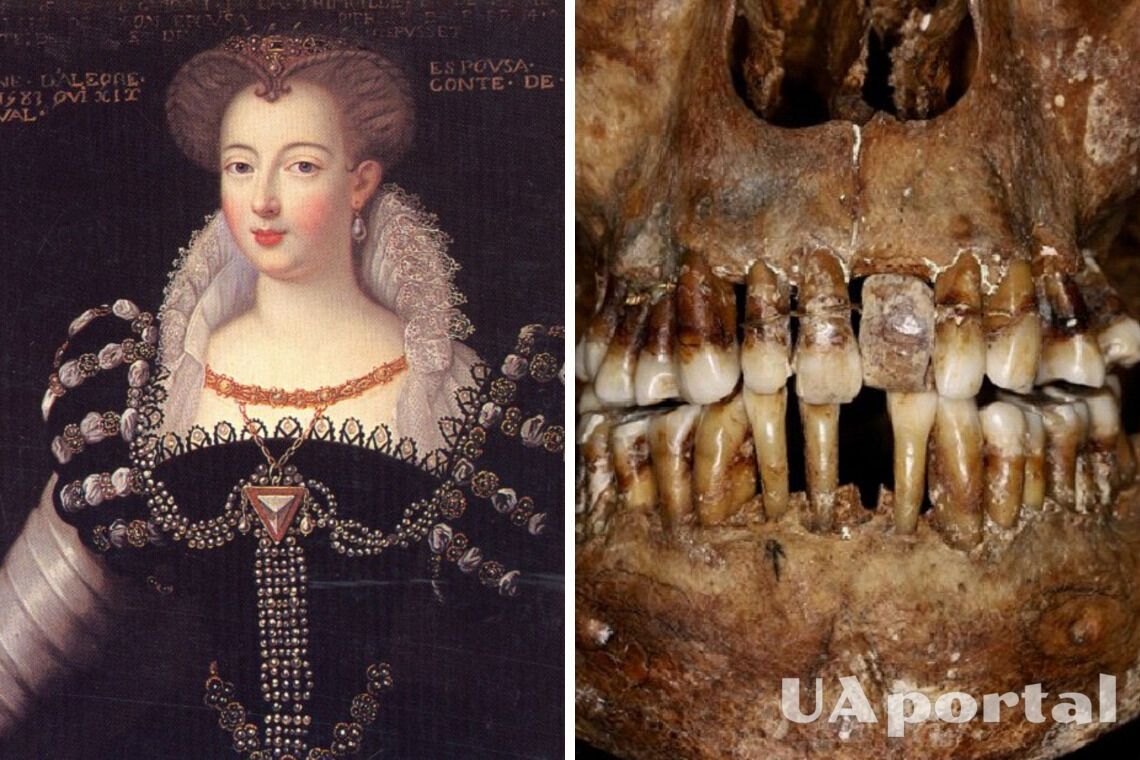 Исследователи рассказали, какая французская графиня держала зубы во рту с помощью золотой проволоки (фото)