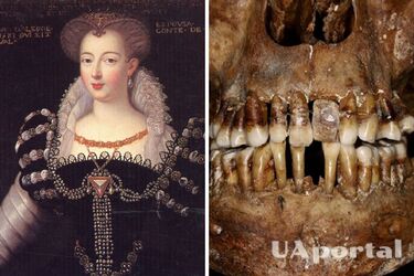 Дослідники розповіли, яка французька графиня тримала зуби в роті за допомогою золотого дроту (фото)