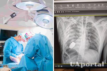 Граната в грудной клетке на фото (справа)