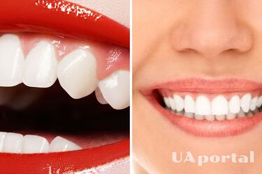 Dentyści wymieniają dwa najczęstsze błędy podczas szczotkowania zębów