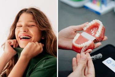Eliners or braces: which is better for the orthodontic treatment