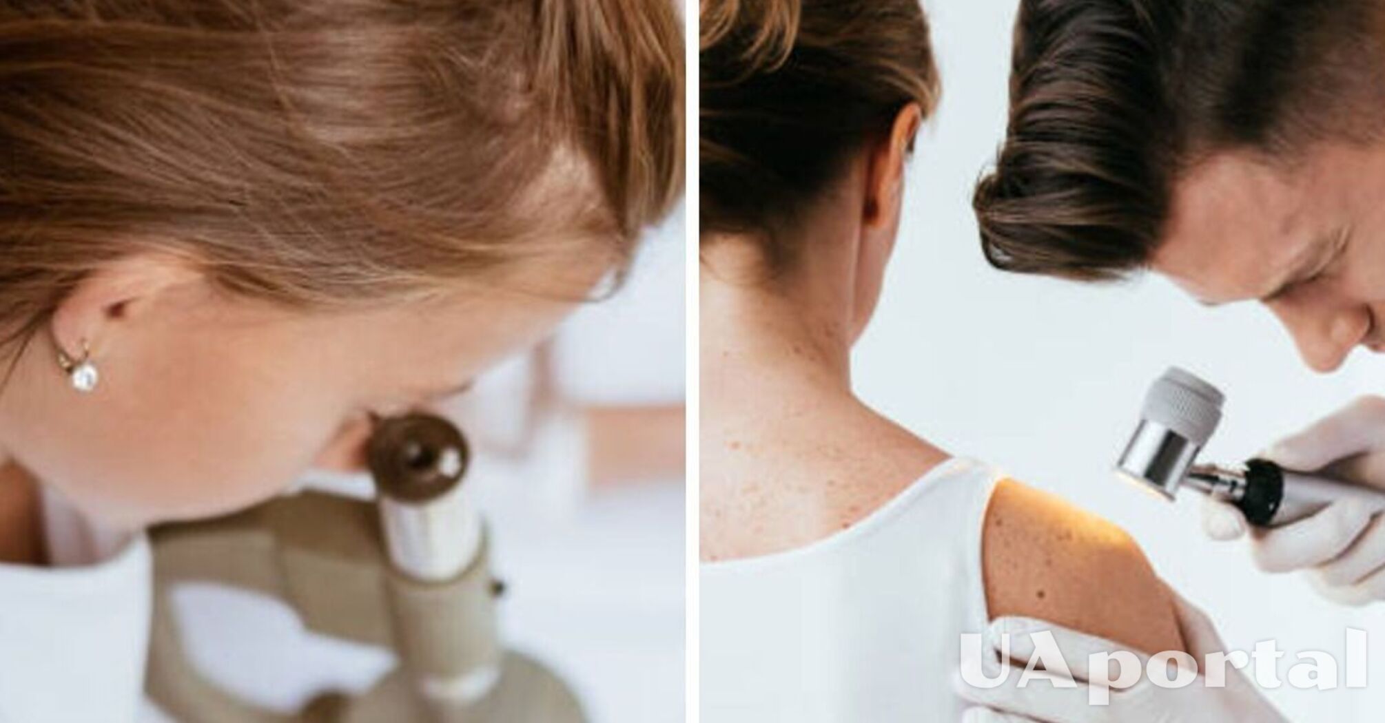It's not melanoma: scientists name the deadliest form of skin cancer