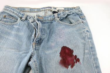 Как вывести засохшие пятна крови из одежды: эффективные советы